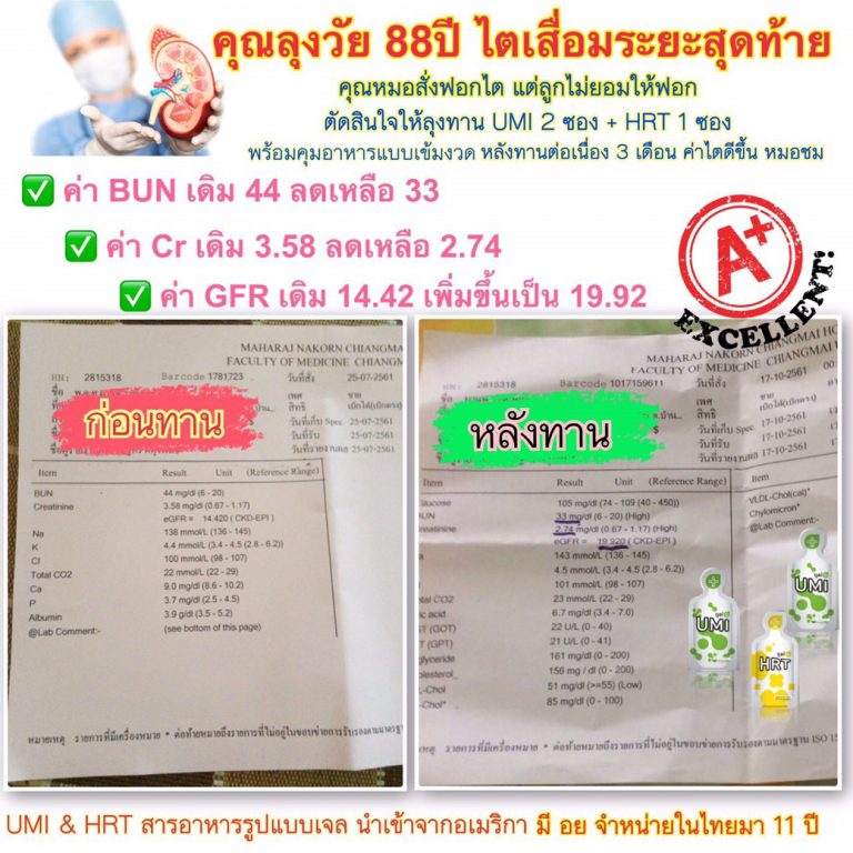 ไตเสื่อม ไตวาย ดูแลได้